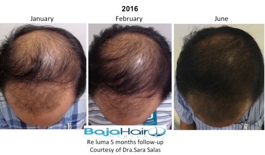 Hair2